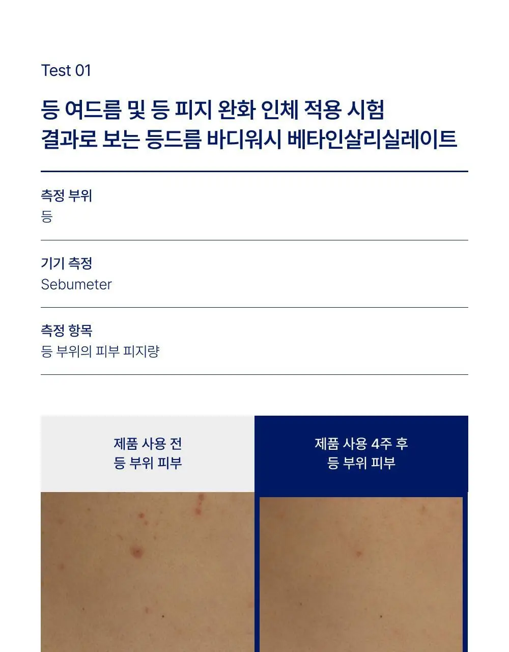 [대용량] 바이오가 등드름 바디워시 베타인살리실레이트 1000ml 기획(+바디미스트 20ml) 상세페이지 12